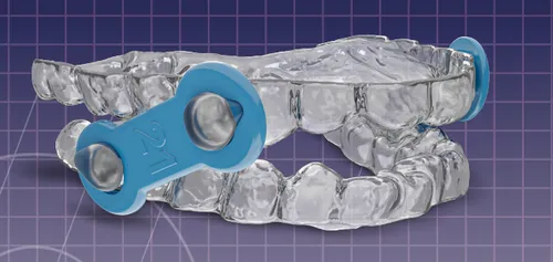 EMA (Elastic Mandibular Advancement) sleep apnea appliance