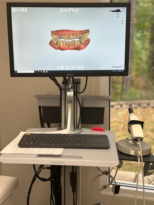TRIOS digital intraoral scanner for comfortable impressions