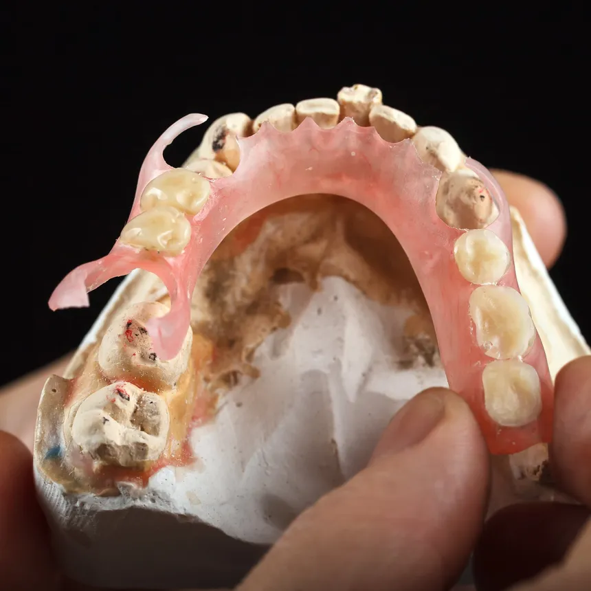 Custom-fitted dentures restoring a complete, natural smile